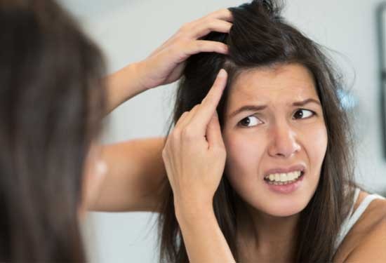 7 حلول منزلية لـ علاج قشرة الشعر 